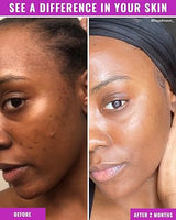 Good Molecules Niacinamide Brightening Toner 120ML - True Glow Naturals