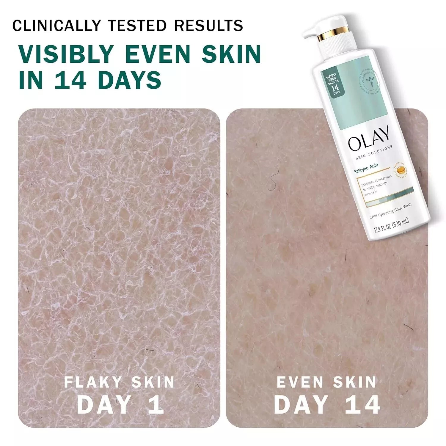 olay body wash, salicylic acid body wash, exfoliating body wash, smoothing body wash, clarifying body wash, body wash for rough skin, pore cleansing body wash, daily body cleanser, hydrating body wash, skin texture body wash, olay exfoliating wash